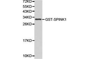 Western blot analysis of GST-SPINK1 recombinant protein using SPINK1 antibody. (SPINK1 抗体)