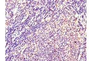 Immunohistochemistry of paraffin-embedded human lymph node tissue using ABIN7146099 at dilution of 1:100 (CXCR2 抗体  (AA 1-40))