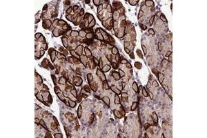 Immunohistochemical staining of human stomach with GDF6 polyclonal antibody  shows strong membranous and cytoplasmic positivity in glandular cells. (GDF6 抗体)