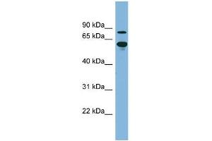 Human kidney; WB Suggested Anti-ABCF2 Antibody Titration: 0. (ABCF2 抗体  (N-Term))
