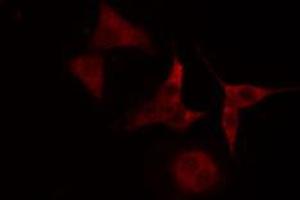 ABIN6272388 staining Hela cells by IF/ICC.