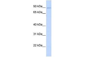 WB Suggested Anti-ZNF408 Antibody Titration:  0. (ZNF408 抗体  (Middle Region))