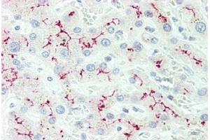 Human Liver: Formalin-Fixed, Paraffin-Embedded (FFPE) (IL12RB2 抗体  (AA 756-783))