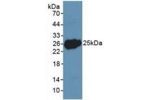 Detection of Recombinant LIF, Human using Polyclonal Antibody to Leukemia Inhibitory Factor (LIF) (LIF 抗体  (AA 2-201))