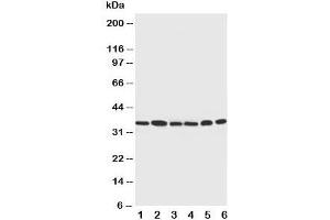 Western blot testing of Cdk4 antibody and Lane 1:  rat thymus;  2: HeLa;  3: MCF-7;  4: A549;  5: COLO320;  6: Jurkat cell lysate (CDK4 抗体  (C-Term))