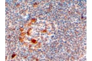 ABIN184577 (4µg/ml) staining of paraffin embedded Human Lymph Node. (ZCCHC11 抗体  (C-Term))