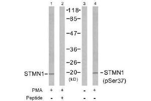 Image no. 2 for anti-Stathmin 1 (STMN1) (pSer37) antibody (ABIN196970) (Stathmin 1 抗体  (pSer37))