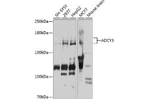 Western blot analysis of extracts of various cell lines, using  antibody (ABIN6129186, ABIN6136561, ABIN6136562 and ABIN6223849) at 1:1000 dilution. (ADCY3 抗体  (AA 1-80))