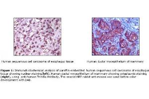 Image no. 1 for Rabbit anti-Mouse IgG antibody (HRP) (ABIN305604) (兔 anti-小鼠 IgG Antibody (HRP))