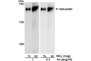 Western Blotting (WB) image for anti-Regulation of Nuclear Pre-mRNA Domain Containing 2 (RPRD2) (AA 1000-1050) antibody (ABIN7452562) (RPRD2 抗体  (AA 1000-1050))