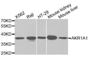 Western blot analysis of extracts of various cell lines, using AKR1A1 antibody. (AKR1A1 抗体  (AA 1-325))