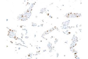 Immunocytochemistry (ICC) image for anti-Cyclin-Dependent Kinase Inhibitor 1A (p21, Cip1) (CDKN1A) (AA 100-150) antibody (ABIN7795765) (Recombinant p21 抗体  (AA 100-150))