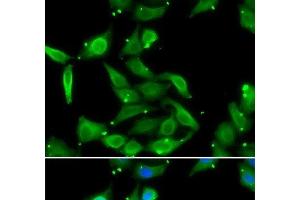 Immunofluorescence analysis of U2OS cells using GAMT Polyclonal Antibody (GAMT 抗体)