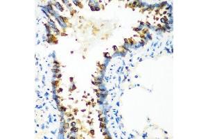 Immunohistochemistry of paraffin-embedded rat lung using MT-CO2 antibody. (COX2 抗体  (AA 100-200))