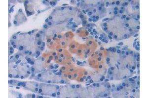 Detection of TGFb2 in Rat Pancreas Tissue using Polyclonal Antibody to Transforming Growth Factor Beta 2 (TGFb2)