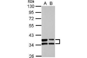 WB Image Sample (30 ug of whole cell lysate) A: A549 B: HCT116 10% SDS PAGE antibody diluted at 1:10000 (Annexin A3 抗体)