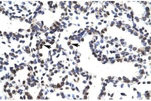 Human Lung; LHX3 antibody - middle region in Human Lung cells using Immunohistochemistry (LHX3 抗体  (Middle Region))