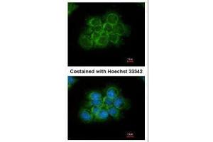 ICC/IF Image Immunofluorescence analysis of methanol-fixed A431, using CRK, antibody at 1:200 dilution. (Crk 抗体  (Center))