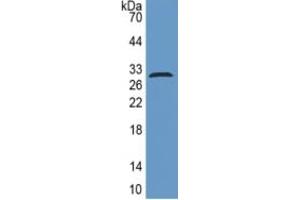 WB of Protein Standard: different control antibodies against Highly purified E. (ITGB6 CLIA Kit)