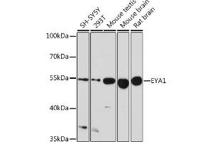 Western blot analysis of extracts of various cell lines, using EY Rabbit pAb (ABIN6135167, ABIN6140386, ABIN6225031 and ABIN6225033) at 1:1000 dilution. (EYA1 抗体  (AA 100-250))