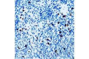 Immunohistochemistry of paraffin-embedded mouse spleen using SPN antibody (ABIN5973813) at dilution of 1/100 (40x lens). (CD43 抗体)