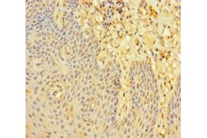 Immunohistochemistry of paraffin-embedded human tonsil tissue using ABIN7168070 at dilution of 1:100 (LMO2 抗体  (AA 1-100))