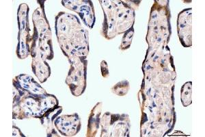 IHC analysis of Neurofibromin/NF1 using anti-Neurofibromin/NF1 antibody (ABIN7600197). (Neurofibromin 1 抗体  (AA 160-270))