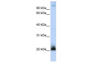 WB Suggested Anti-ITGB3BP Antibody Titration: 0. (ITGB3BP 抗体  (N-Term))
