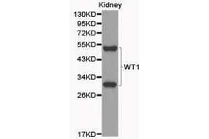 Western Blotting (WB) image for anti-Wilms Tumor 1 (WT1) antibody (ABIN1875356) (WT1 抗体)