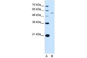 KCNQ2 antibody used at 0. (KCNQ2 抗体  (N-Term))