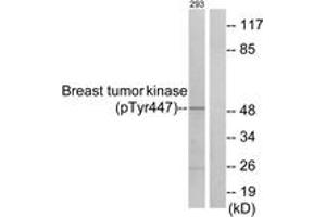 Western blot analysis of extracts from 293 cells treated with EGF 200ng/ml 30', using Breast Tumor Kinase (Phospho-Tyr447) Antibody. (PTK6 抗体  (pTyr447))