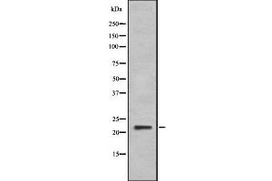 Western blot analysis IFNA6 using HeLa whole cell lysates (IFNA6 抗体  (C-Term))