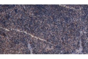 Detection of CASP3 in Rat Spleen Tissue using Polyclonal Antibody to Caspase 3 (CASP3) (Caspase 3 抗体  (AA 29-175))