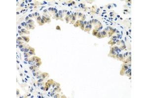 Immunohistochemistry of paraffin-embedded Mouse lung using BMP5 Polyclonal Antibody at dilution of 1:100 (40x lens). (BMP5 抗体)