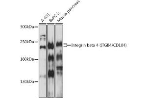 Western blot analysis of extracts of various cells, using Integrin beta 4 (ITGB4/CD104) antibody (ABIN1680489, ABIN3015361, ABIN3015362 and ABIN6214007) at 1:1000 dilution. (Integrin beta 4 抗体  (AA 28-310))
