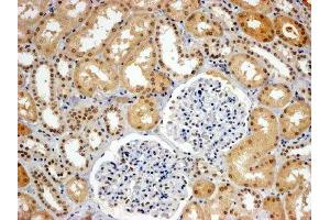 ABIN2560775 (4µg/ml) staining of paraffin embedded Human Kidney. (WRNIP1 抗体  (C-Term))