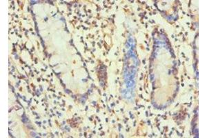 Immunohistochemistry of paraffin-embedded human small intestine tissue using ABIN7155347 at dilution of 1:100 (Histone H1-Like (LOC107807853) (AA 1-194) 抗体)