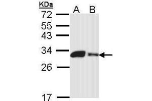 WB Image Sample (30 ug of whole cell lysate) A: 293T B: A431 , 12% SDS PAGE antibody diluted at 1:1000 (CA2 抗体)