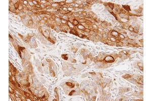 IHC-P Image Immunohistochemical analysis of paraffin-embedded SCC4 xenograft, using GAS2L1, antibody at 1:100 dilution. (GAS2L1 抗体)