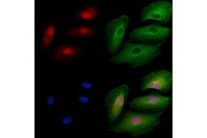 ABIN6257569 and ABIN6275749 staining  cells by IF/ICC. (ZNF446 抗体  (Internal Region))