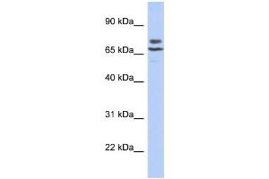 WB Suggested Anti-C3orf39 Antibody Titration:  0. (C3orf39 抗体  (N-Term))