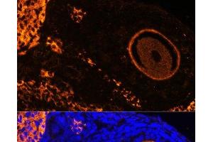 Zona Pellucida Glycoprotein 3 抗体