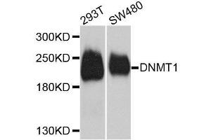 Western blot analysis of extracts of various cell lines, using DNMT1 antibody. (DNMT1 抗体  (AA 1-270))