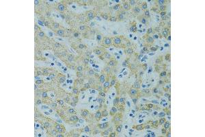 Immunohistochemistry of paraffin-embedded human liver using STX1A antibody (ABIN1876774) at dilution of 1:100 (40x lens). (STX1A 抗体)
