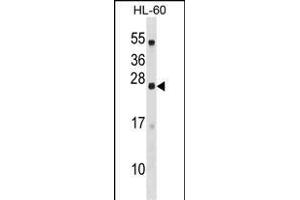 C18orf26 Antibody (N-term) (ABIN1539422 and ABIN2848478) western blot analysis in HL-60 cell line lysates (35 μg/lane). (DYNAP 抗体  (N-Term))