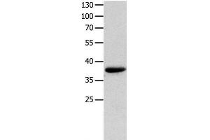 Western Blot analysis of Mouse muscle tissue using MYOZ1 Polyclonal Antibody at dilution of 1:1000