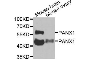 Western blot analysis of extracts of mouse brain and mouse ovary cells, using PANX1 antibody. (PANX1 抗体)