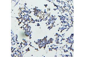 IHC analysis of CETP using anti-CETP antibody (ABIN7602439). (CETP 抗体  (AA 77-353))