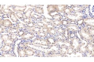 Immunohistochemistry (IHC) image for anti-C-Fos Induced Growth Factor (Vascular Endothelial Growth Factor D) (Figf) (AA 89-354) antibody (ABIN7431200)