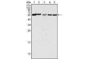 Western Blot showing PAK2 antibody used against Hela (1), Jurkat (2), A549 (3), HEK293 (4) and K562 (5) cell lysate. (PAK2 抗体)